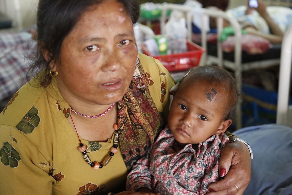 A woman holding a young child on her lap in what appears to be a medical setting with hospital beds and supplies in the background. Both have visible skin conditions. The woman is wearing a yellow floral top with a patterned shawl and beaded necklace, and the child is in a patterned shirt. They are looking directly at the camera with neutral expressions.